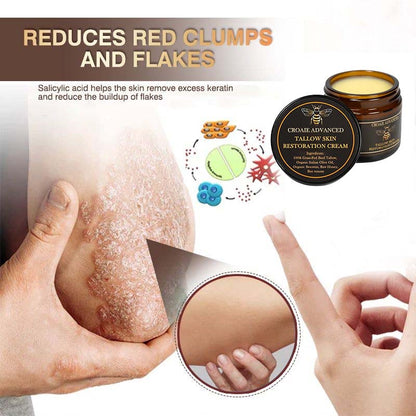 CROAIE ADVANCED® 𝐏𝐬𝐨𝐫𝐢𝐚𝐬𝐢𝐬 & 𝐄𝐜𝐳𝐞𝐦𝐚 𝐑𝐞𝐥𝐢𝐞𝐟 𝐂𝐫𝐞𝐚𝐦 🐝✅Clinically Proven 👩‍⚕️Dermatologist Trusted ·  🇺🇸FDA Certification