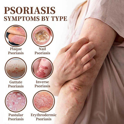 CROAIE ADVANCED® 𝐏𝐬𝐨𝐫𝐢𝐚𝐬𝐢𝐬 & 𝐄𝐜𝐳𝐞𝐦𝐚 𝐑𝐞𝐥𝐢𝐞𝐟 𝐂𝐫𝐞𝐚𝐦 🐝✅Clinically Proven 👩‍⚕️Dermatologist Trusted ·  🇺🇸FDA Certification
